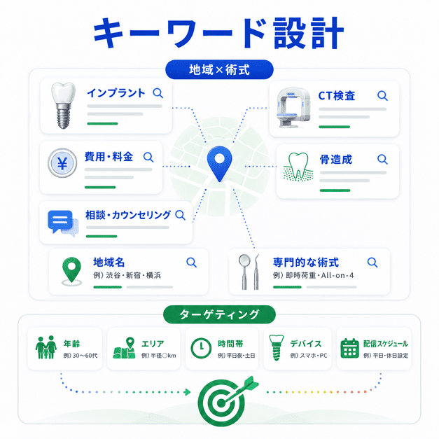 インプラント広告で費用・相談・CT・骨造成・地域名などのキーワードと配信ターゲティングを整理する設計図