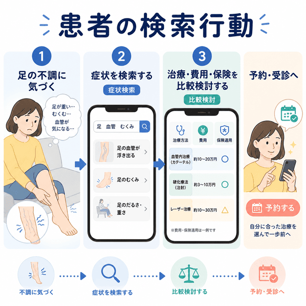 足のむくみや血管のふくらみに気づいた患者が症状検索から比較検討を経て予約へ進む流れを示したイラスト