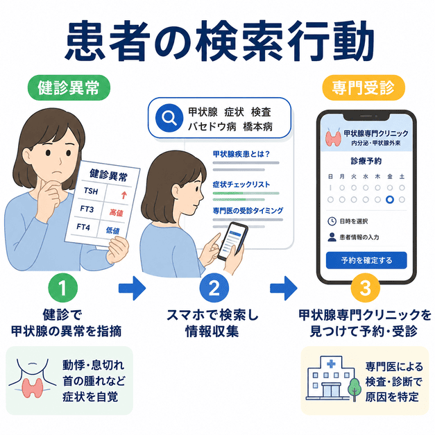 健診異常や症状をきっかけに甲状腺疾患を疑う患者が検索して専門受診を決める流れを表したイラスト