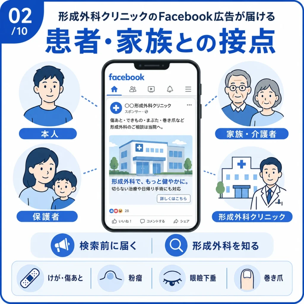 形成外科クリニックのFacebook広告が本人や家族に届く接点を示すイラスト