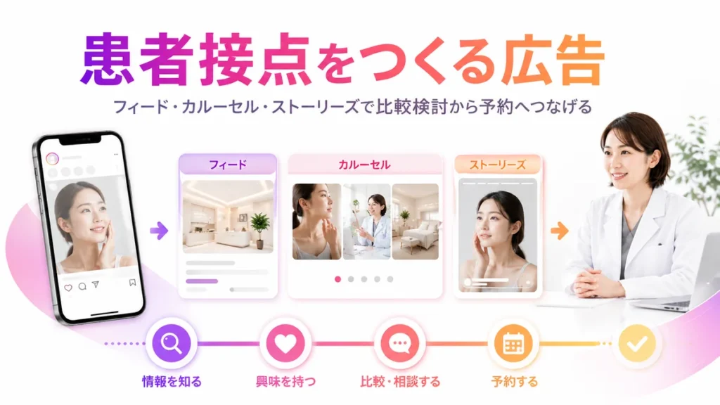 美容外科のInstagram広告で患者接点をつくる流れを示すイラスト