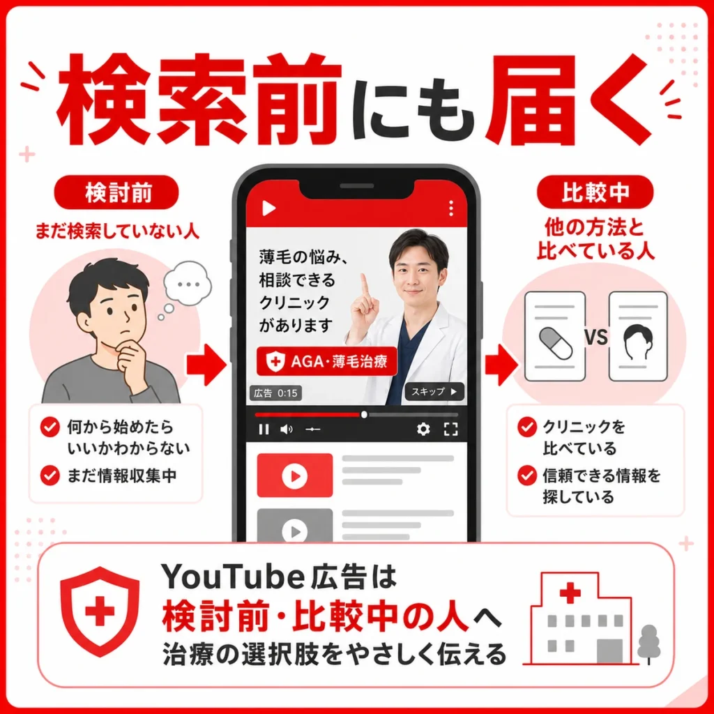 検索前や比較中の人にAGA治療の選択肢を届けるYouTube広告の役割を示すイラスト