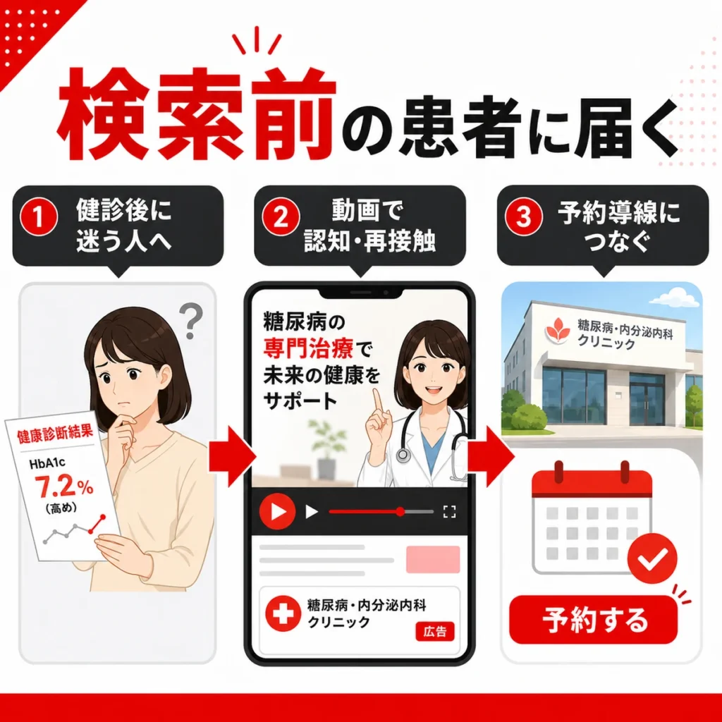検索前の患者にYouTube広告で接点を作り予約導線へつなげる流れを示すイラスト