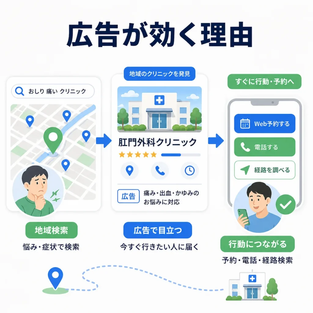 ローカル検索広告から肛門外科クリニックの発見、Web予約や電話につながる流れを示すイラスト