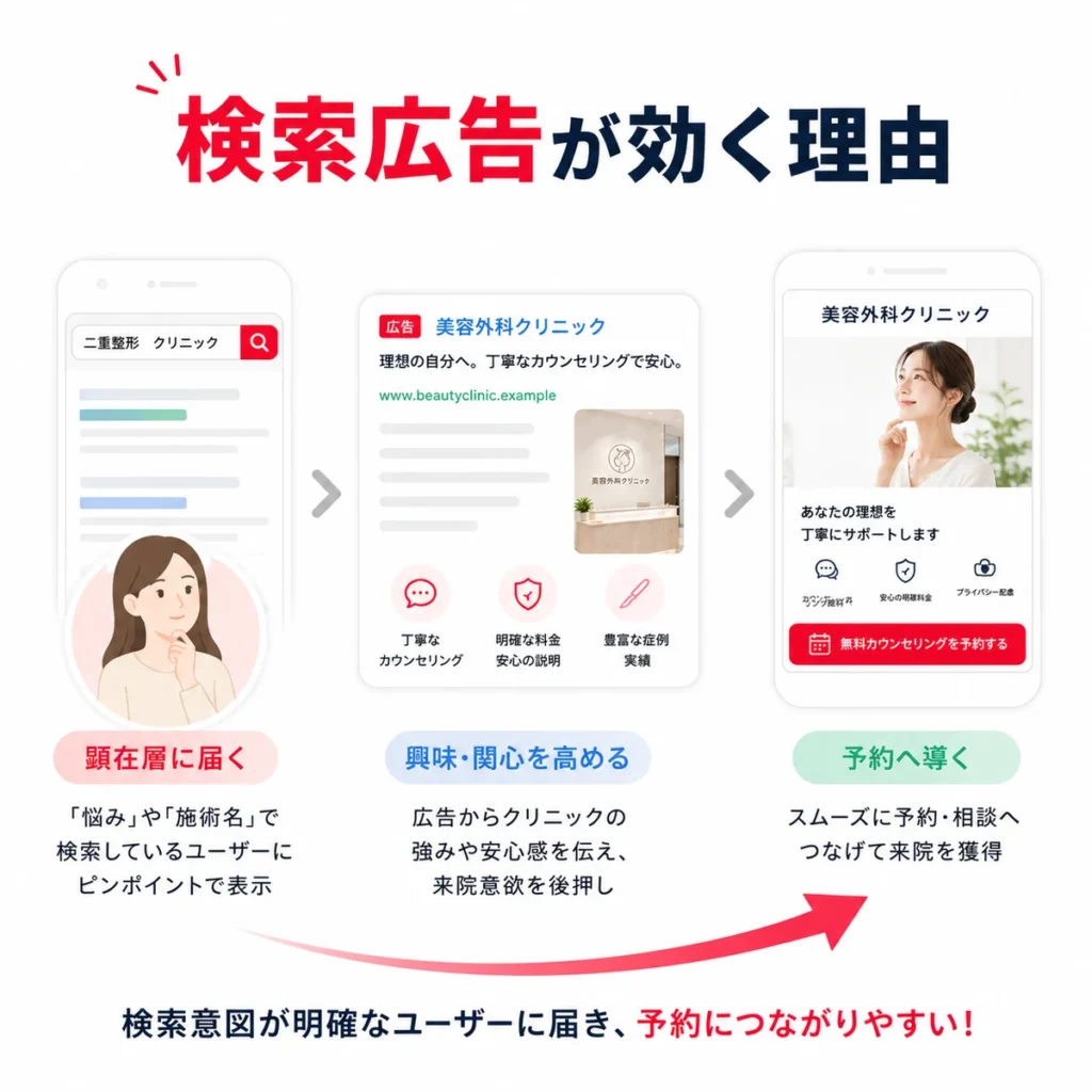 検索広告が美容外科の顕在層に届きカウンセリング予約へつながる流れを示すイラスト