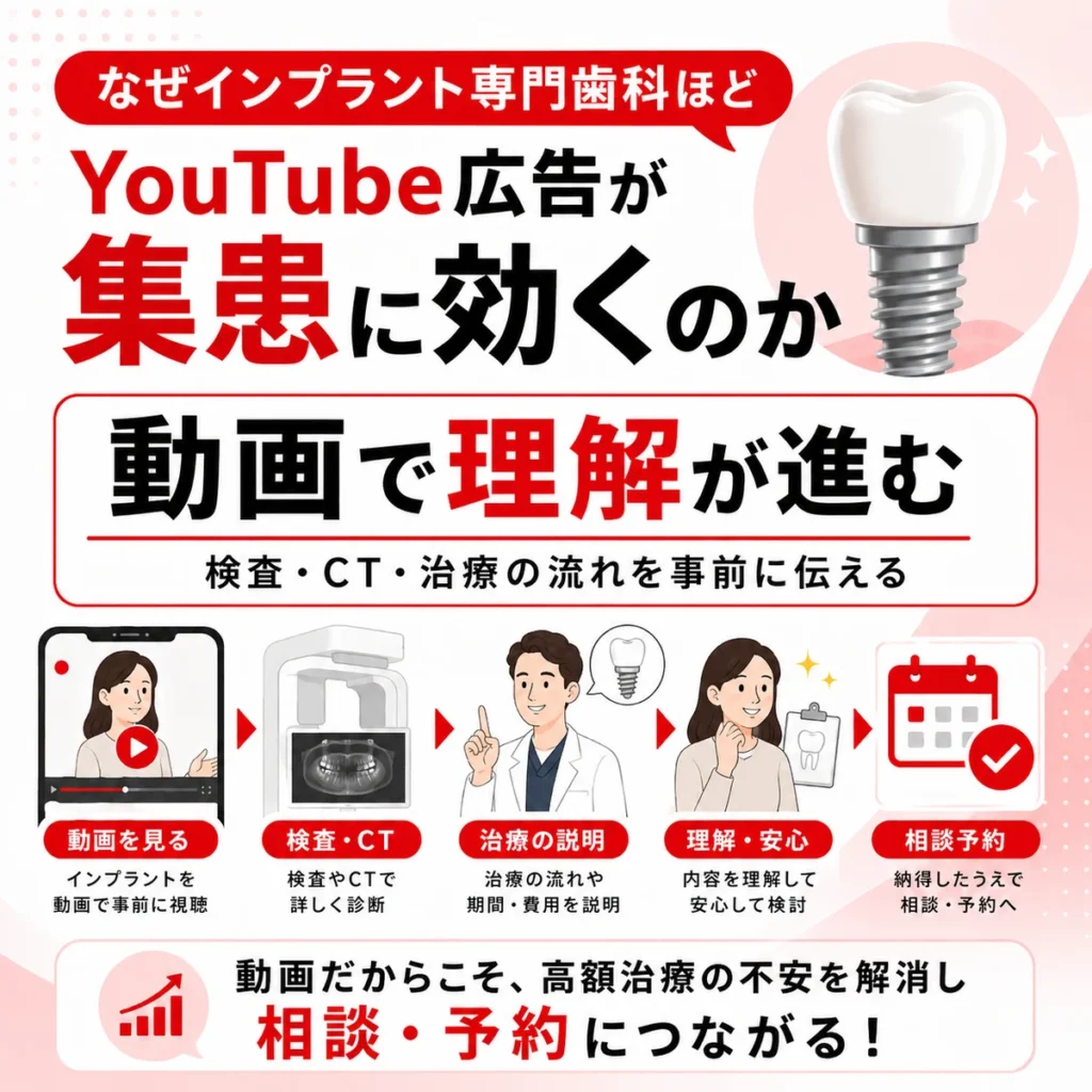 インプラント治療の検査やCTや治療の流れを動画で理解できることを示すイラスト