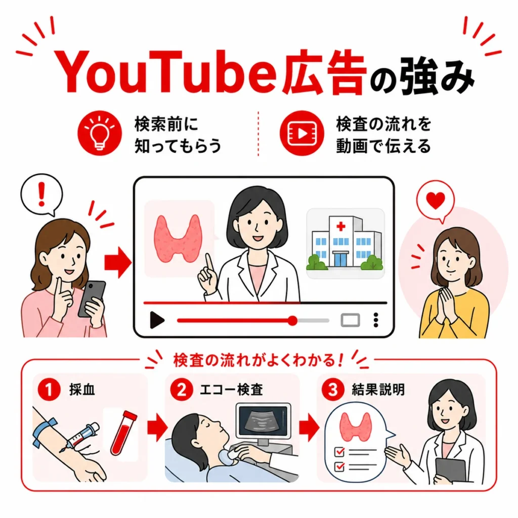 甲状腺専門外来を検索前に知ってもらい、検査の流れを動画で伝える強みを示すイラスト