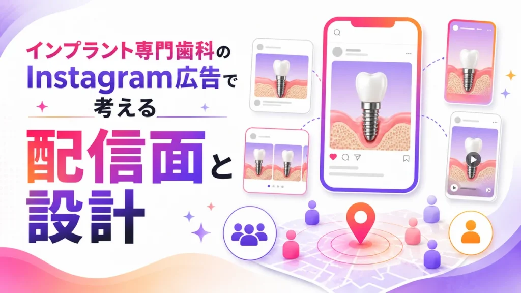 インプラント広告の配信面とオーディエンス設計を表すイラスト