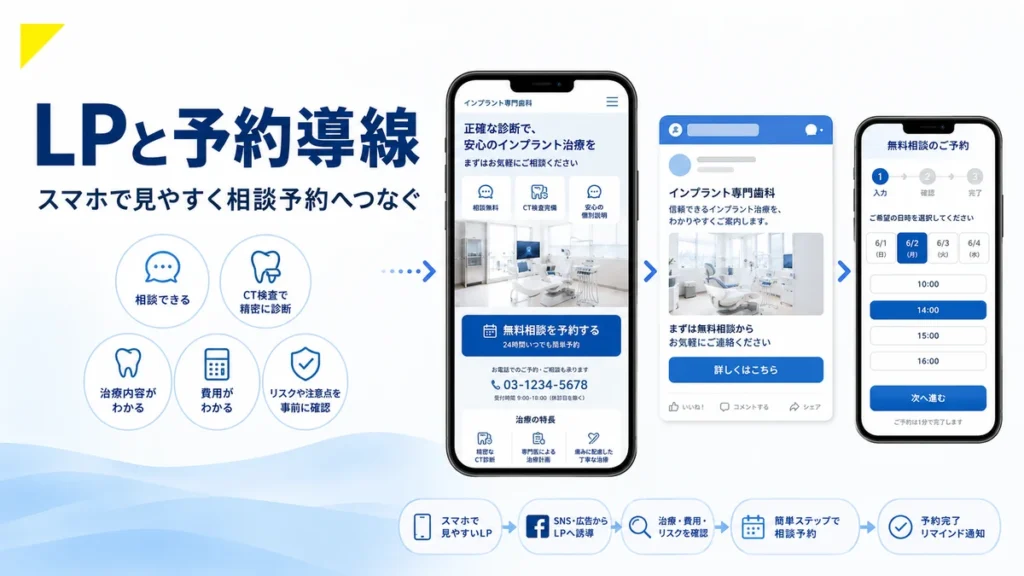 スマホで見やすいLPと予約導線からインプラント相談予約へつなげる流れのイラスト
